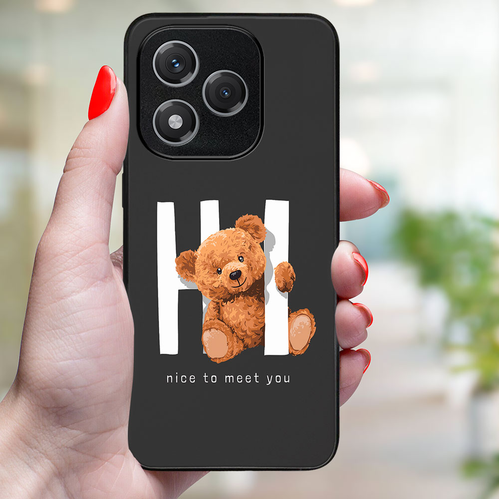 MY ART Védőtok Honor 400 Lite 5G HI (182) készülékhez termék 2. képe