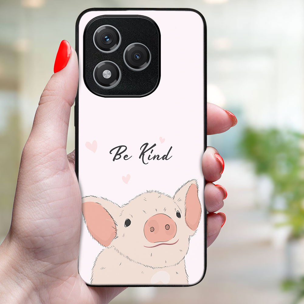 MY ART Védőtok Honor 400 Lite 5G BE KIND (190) készülékhez termék 2. képe