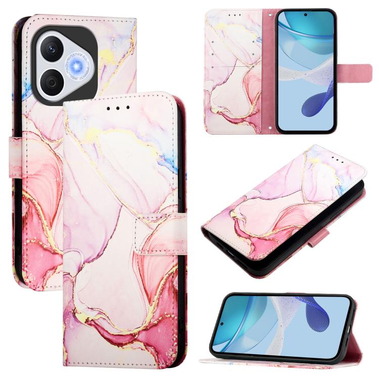 ART MARBLE Tárcatakaró Honor 400 Lite ROSE GOLD akciós termékkép 1