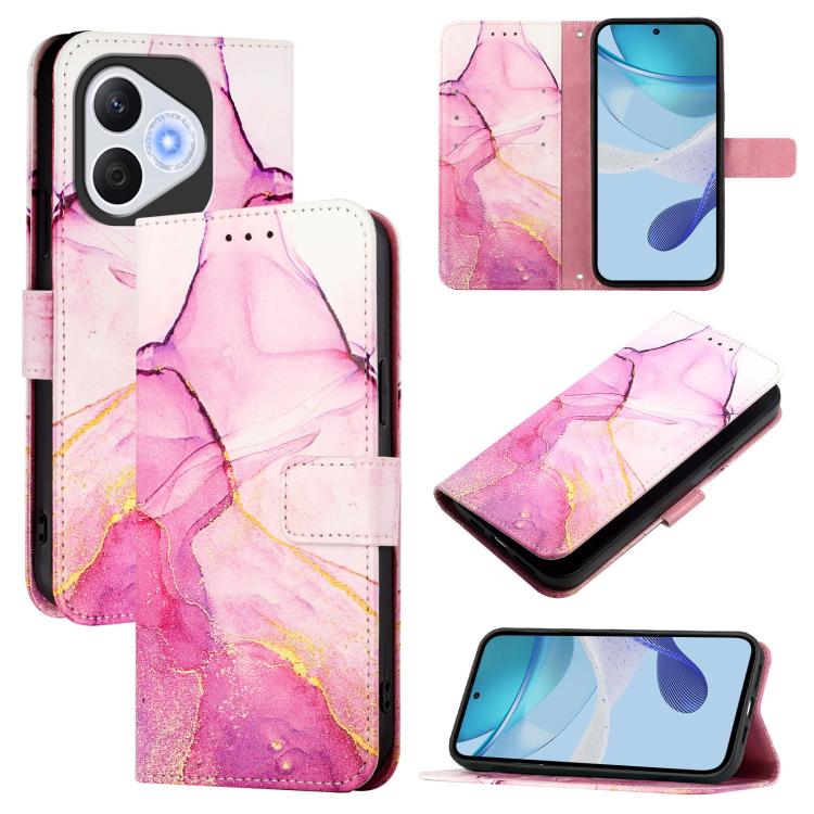 ART MARBLE Tárcatakaró Honor 400 Lite PINK akciós termékkép 1