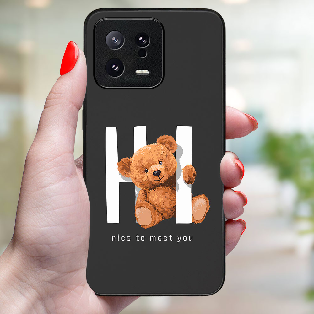 MY ART Védőburkolat a Xiaomi 13 HI-hez (182) termék 2. képe
